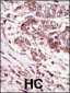 CAMK1G (CaMKI gamma) Antibody (C-term)